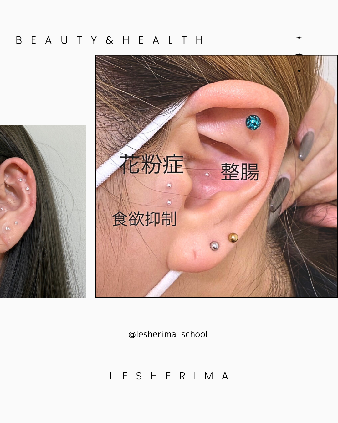 耳つぼジュエリーシール(医療用シール)
