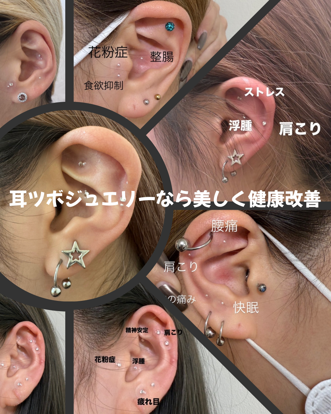耳つぼジュエリーシール(医療用シール)