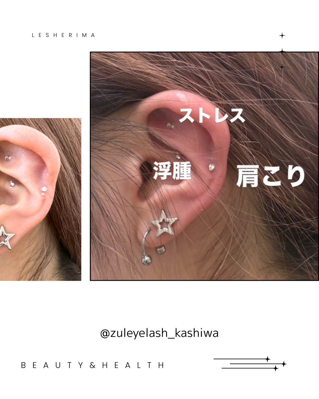 耳つぼジュエリーシール(医療用シール)
